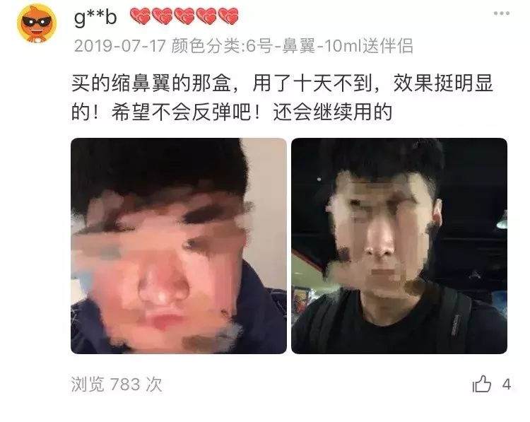 怎么让鼻孔变小（千万别学这4个缩鼻孔方法）(14)